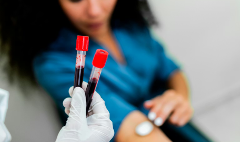 Genetic Testing, Privacy and Discrimination